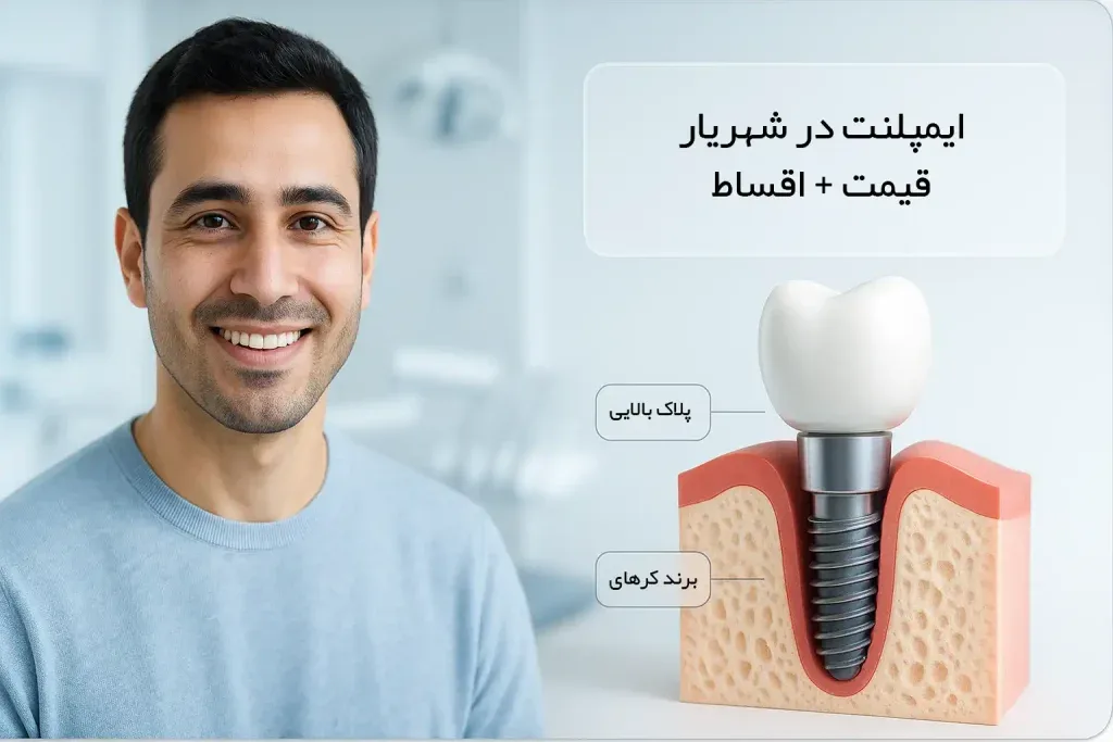 ایمپلنت دندان در شهریار